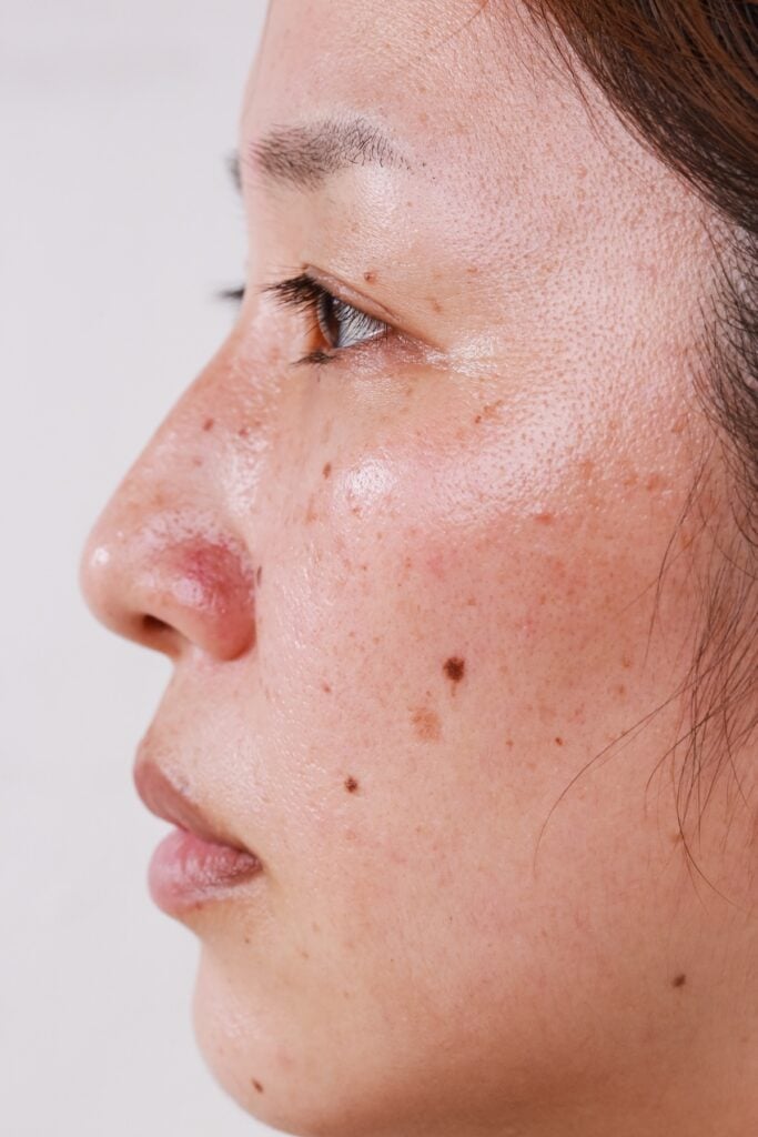 Lancer Dermatology Treatment