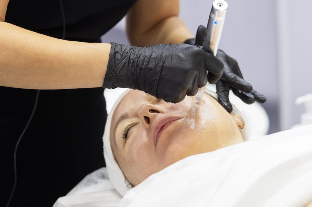 Microneedling DIY Risks