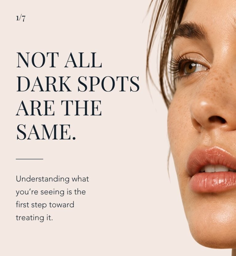 Not All Dark Spots Are the Same